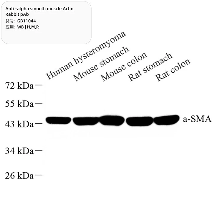 GB11044-100 Anti-alpha smooth muscle Actin Rabbit pAb
