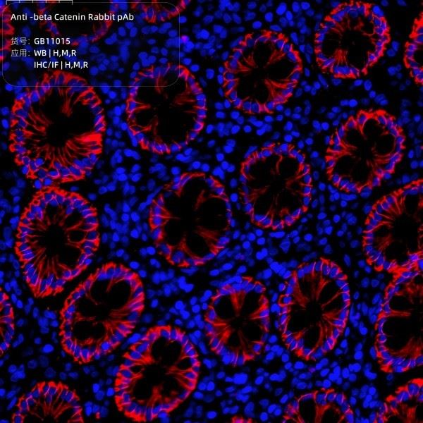 Anti-beta Catenin Rabbit pAb-3(1)