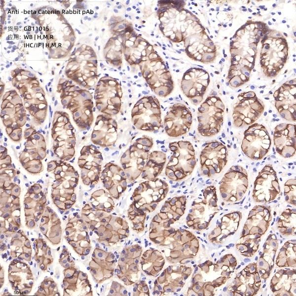 Anti-beta Catenin Rabbit pAb-2(1)