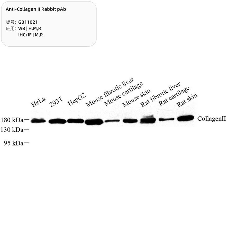 GB11021-100 Anti-Collagen II Rabbit pAb