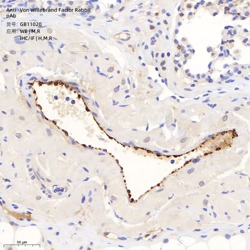 GB11020-100-1 Anti-Von Willebrand Factor Rabbit pAb