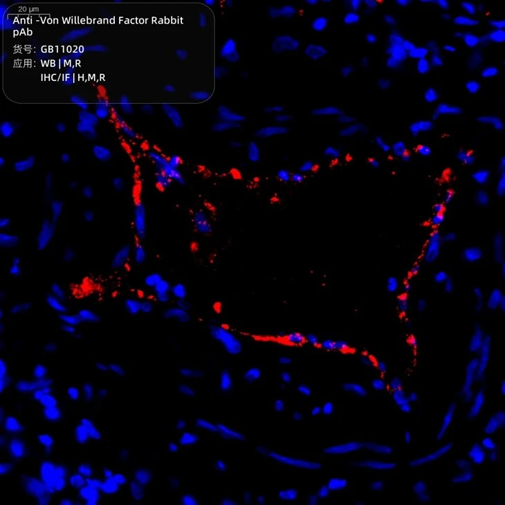 GB11020-100-2 Anti-Von Willebrand Factor Rabbit pAb