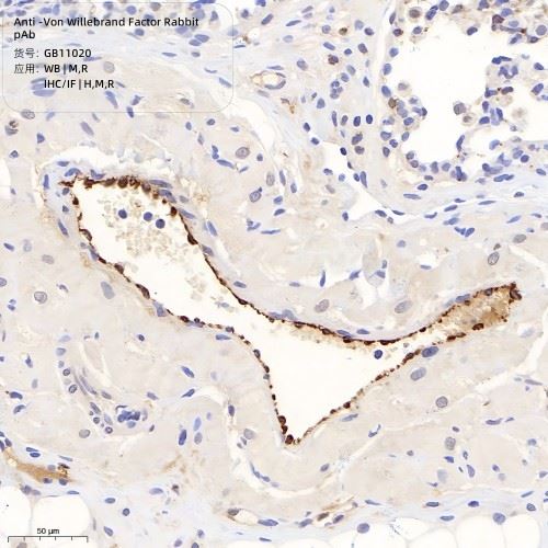GB11020-100 Anti-Von Willebrand Factor Rabbit pAb