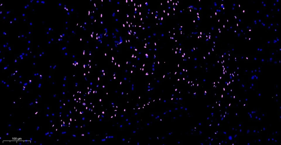 Click-iT 647 Tunel Cell Apoptosis Detection Kit