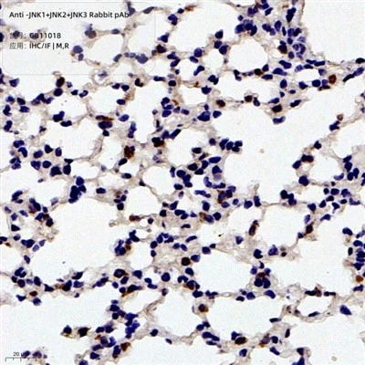 Anti-JNK1+JNK2+JNK3 Rabbit PAb